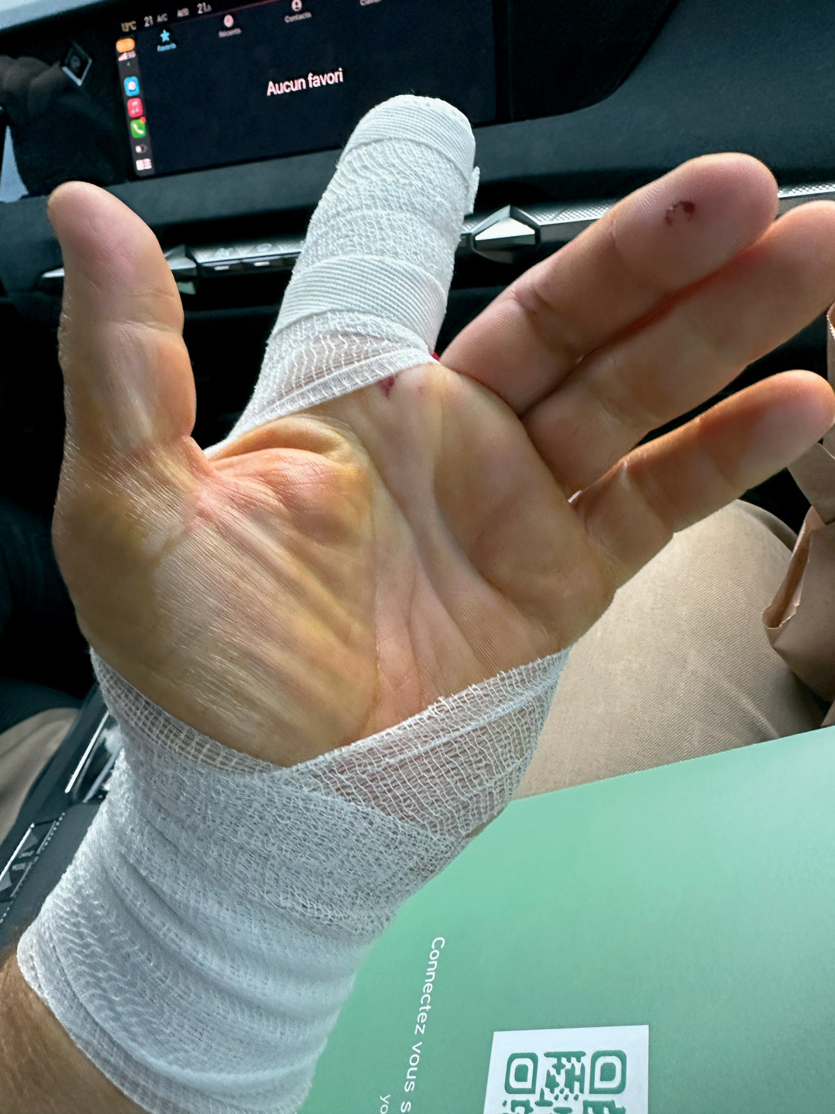 The penalty if you don’t follow the procedure…